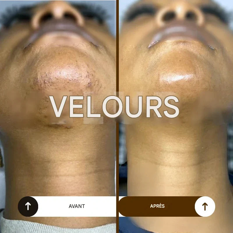 Huile naturelle anti-repousse pour une peau douce et apaisée - Senegal