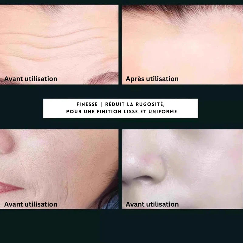 Traitement Anti-Rides Intensif – Action Ciblée & Visible - Yaoundé