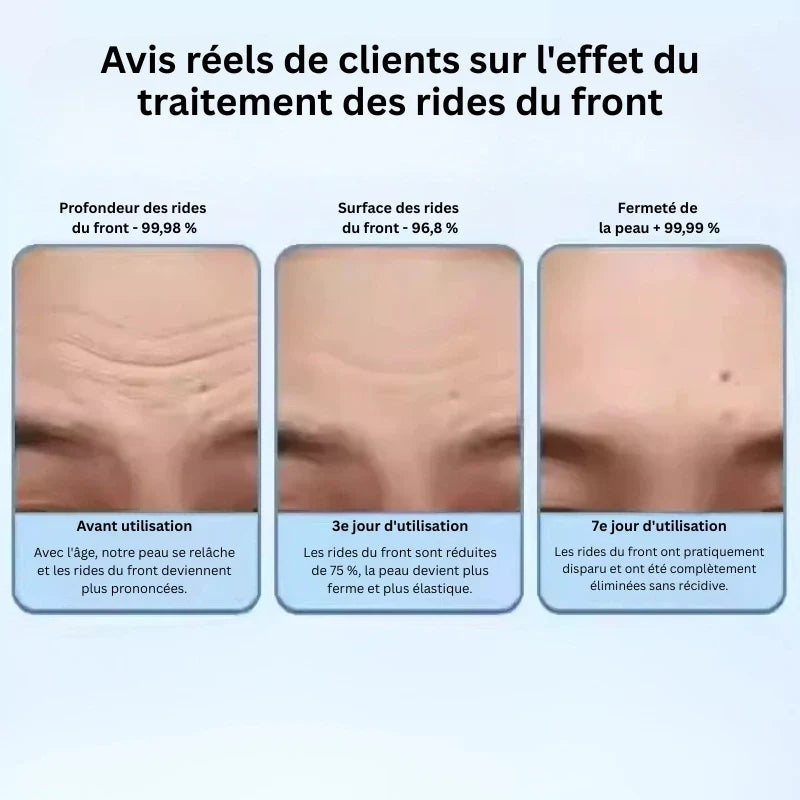 Paille Anti Rides Traitement Anti-Rides Intensif – Action Ciblée & Visible - Chad ...