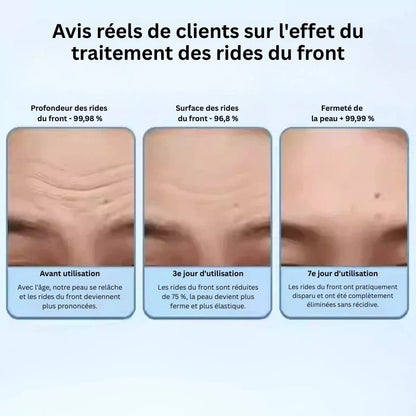 Traitement Anti-Rides Intensif – Action Ciblée & Visible - Yaoundé