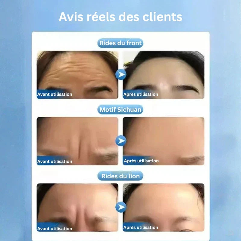 Traitement Anti-Rides Intensif – Action Ciblée & Visible - Yaoundé