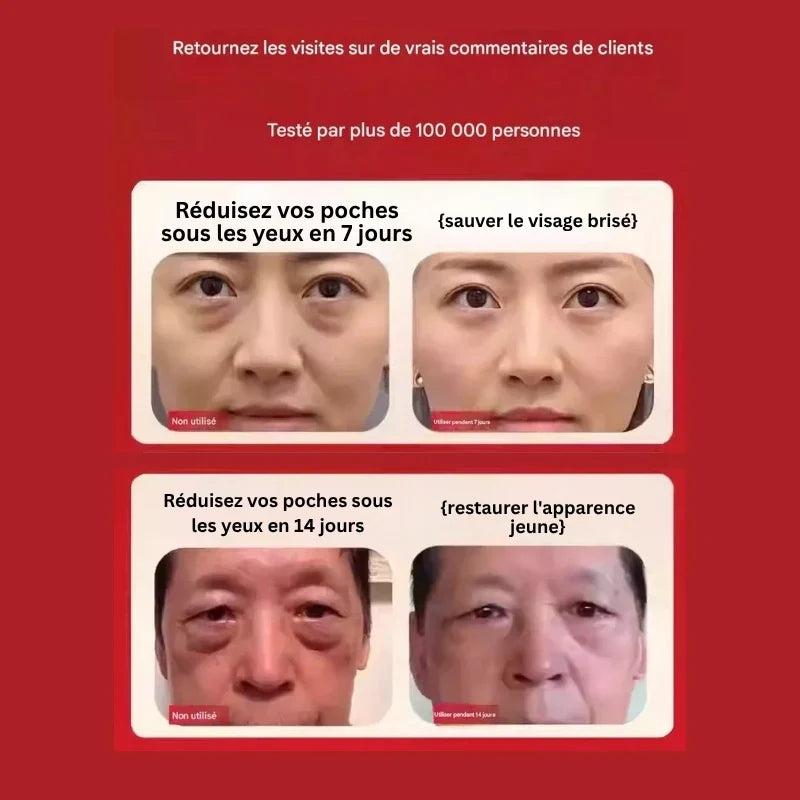 Soin Lissant Contour des Yeux - Burkina Faso