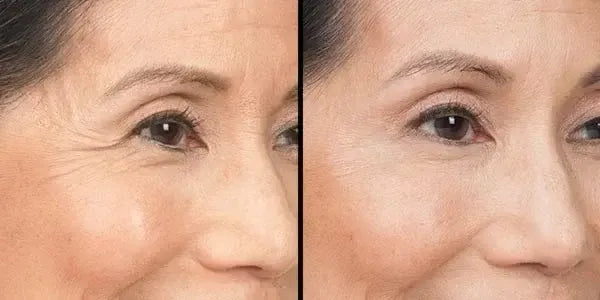 Sérum anti-âge révolutionnaire sans aiguilles - Senegal