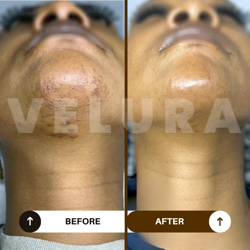 Huile naturelle anti-repousse pour une peau douce et apaisée - Senegal