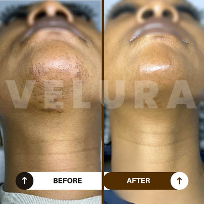 Huile naturelle anti-repousse pour une peau douce et apaisée - Senegal