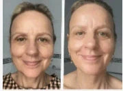 Sérum anti-âge révolutionnaire sans aiguilles - Senegal