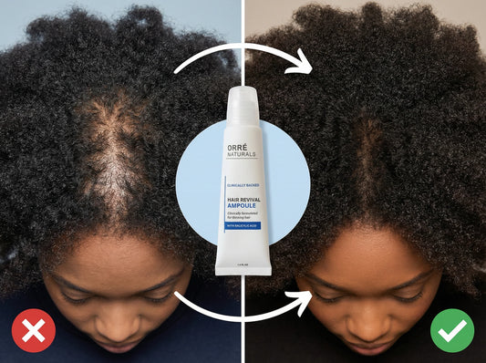 Ampoule Revitalisante Anti-Chute Capillaire - Burkina Faso