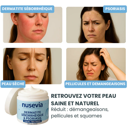 Crème Nusevia | Pour une peau nette, saine et apaisée - Burkina Faso
