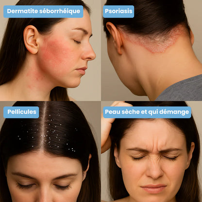 Crème Nusevia | Pour une peau nette, saine et apaisée - Cote D'ivoire