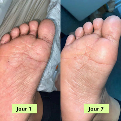 Savon Purifiant Antifongique - Mali