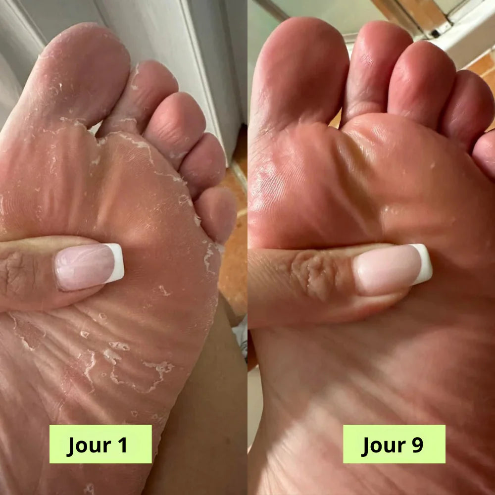 Savon Purifiant Antifongique - Mali