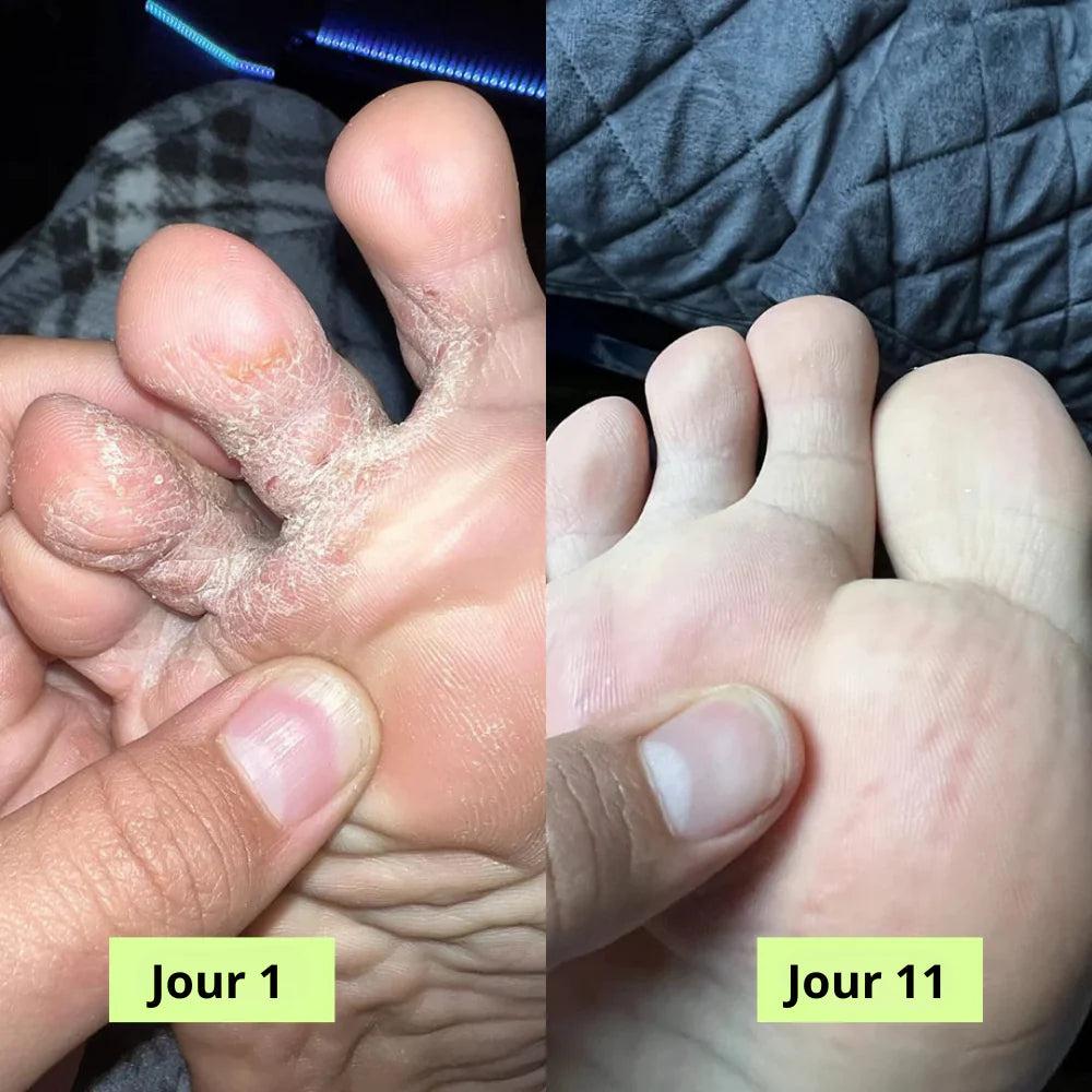 Savon Purifiant Antifongique - Mali