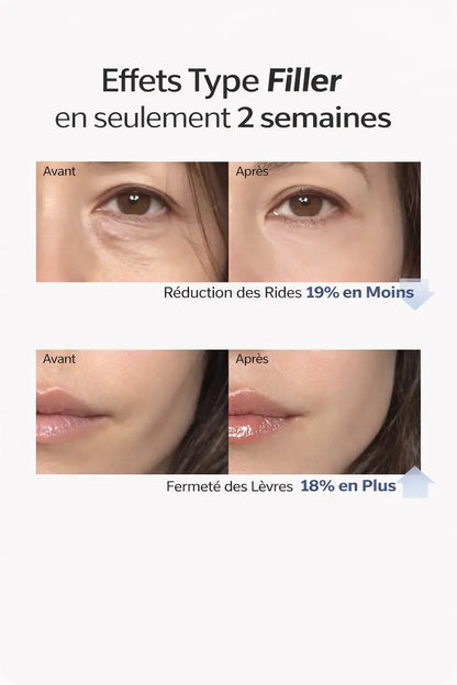 Sérum Collagène Repulpant Intensif - Burkina Faso
